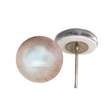 Clouded blind human eyes on wire pin posts